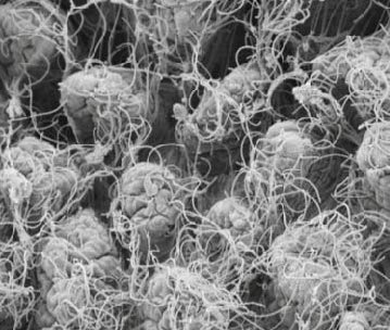 Small intestine with microbes; image source: Elinav Lab, 2012